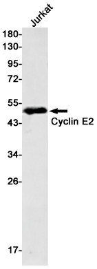 Recombinant Cyclin E2 Monoclonal Antibody (E-AB-81550)