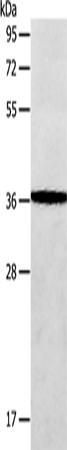 AASDHPPT Polyclonal Antibody (E-AB-14456)