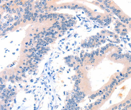 ITGA6 Polyclonal Antibody (E-AB-12770)
