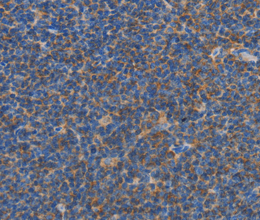 CARD6 Polyclonal Antibody (E-AB-16301)