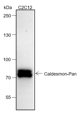 Recombinant Caldesmon/CDM Monoclonal Antibody (AN301452L)
