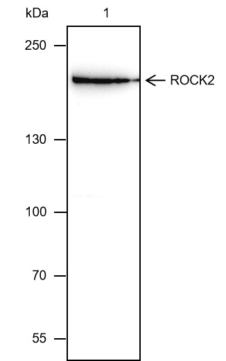 Recombinant ROCK2 Monoclonal Antibody (AN301649L)