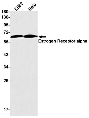 Recombinant Estrogen Receptor alpha Monoclonal Antibody (E-AB-81467)