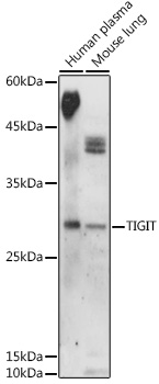 TIGIT Polyclonal Antibody (E-AB-92226)