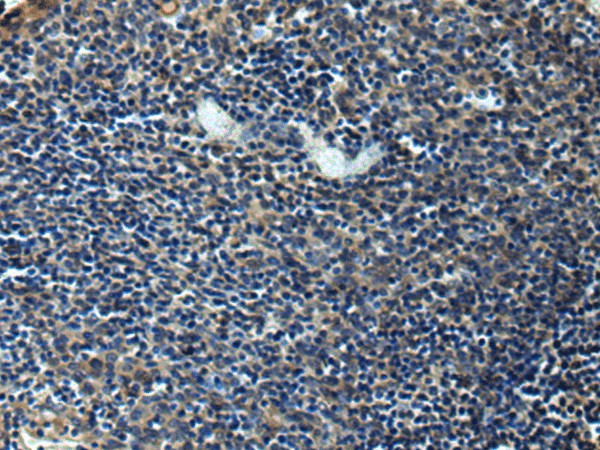 ERLIN1 Polyclonal Antibody (E-AB-19243)