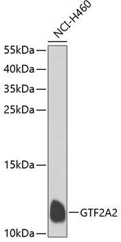 GTF2A2 Polyclonal Antibody (E-AB-62777)