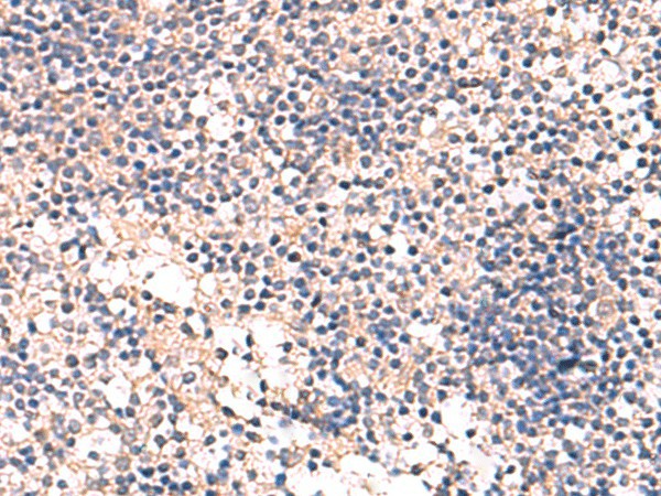 MKS1 Polyclonal Antibody (E-AB-52922)