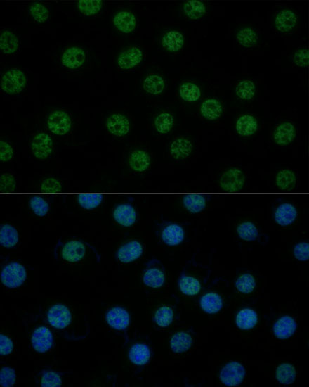 GTF2B Polyclonal Antibody (E-AB-65376)