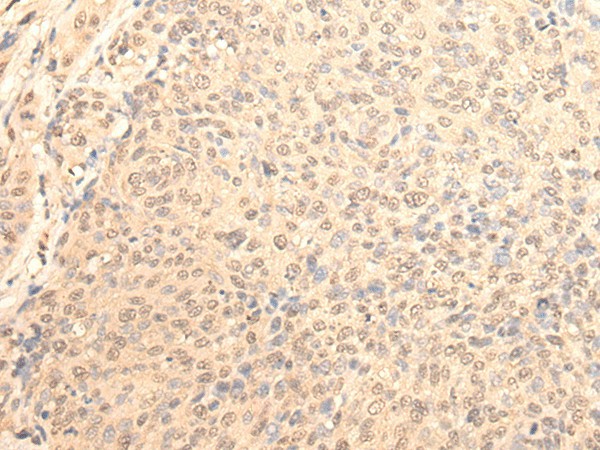 DAZ1 Polyclonal Antibody (E-AB-52570)