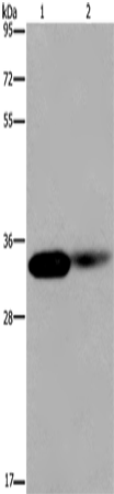 LIMS1 Polyclonal Antibody (E-AB-11365)