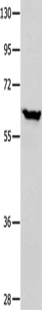 DNAJC7 Polyclonal Antibody (E-AB-10514)