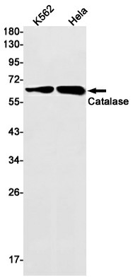 Recombinant Catalase Monoclonal Antibody (E-AB-81542)
