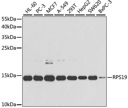 RPS19 Polyclonal Antibody (E-AB-60558)