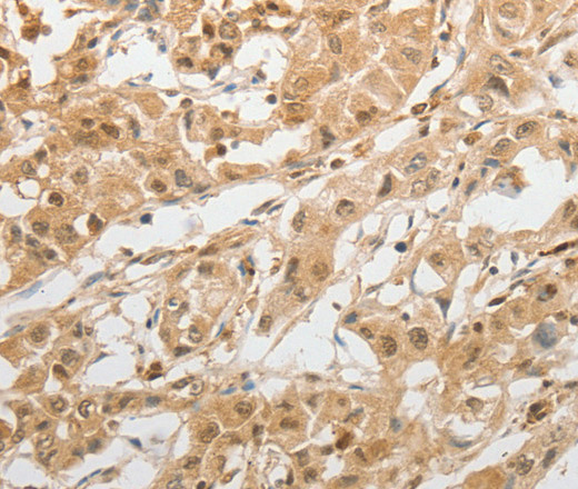 GRIN2C Polyclonal Antibody (E-AB-12600)