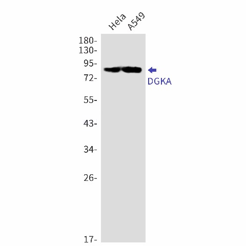 Recombinant DGKA Monoclonal Antibody (E-AB-81551)