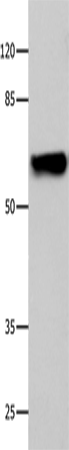 CNGA2 Polyclonal Antibody (E-AB-14008)