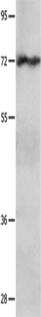 IGF2BP1 Polyclonal Antibody (E-AB-15655)