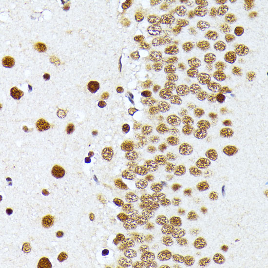 PRMT1 Polyclonal Antibody (E-AB-65778)
