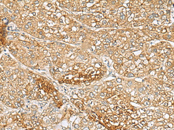 C1orf112 Polyclonal Antibody (E-AB-18564)