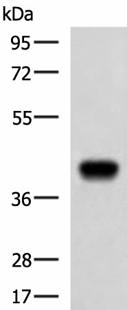 FCRLA Polyclonal Antibody (E-AB-53172)