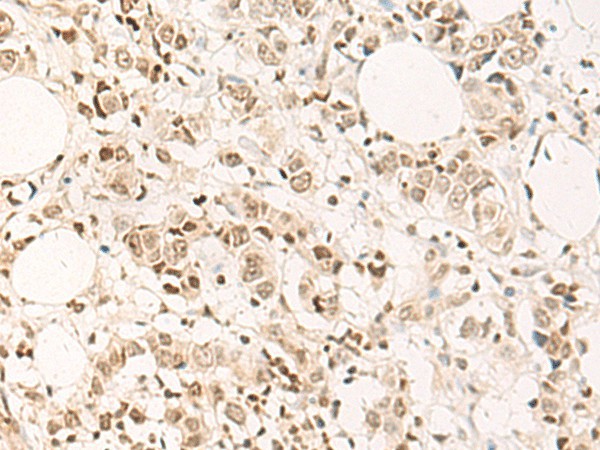 DPPA4 Polyclonal Antibody (E-AB-19445)