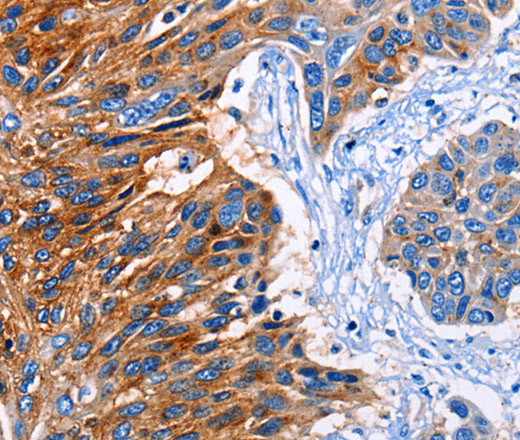 CLEC2B Polyclonal Antibody (E-AB-14006)