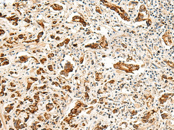 GPR160 Polyclonal Antibody (E-AB-19949)