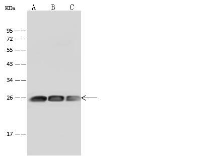 Recombinant GSTP1 Monoclonal Antibody (AN300126P)