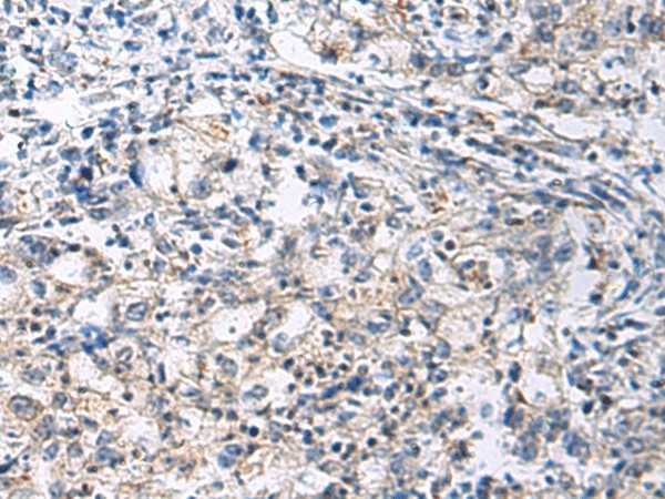 SLC30A3 Polyclonal Antibody (E-AB-53183)