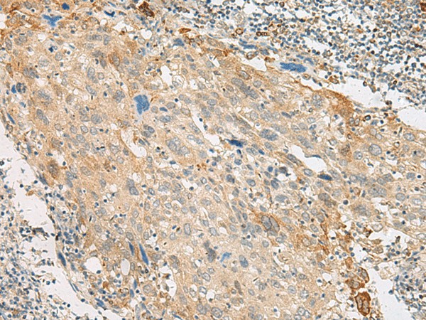 GPR151 Polyclonal Antibody (E-AB-18013)