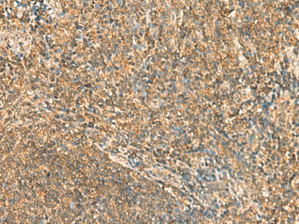 SSSCA1 Polyclonal Antibody (E-AB-18934)