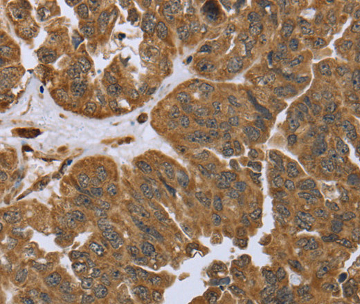 IKBIP Polyclonal Antibody (E-AB-11324)