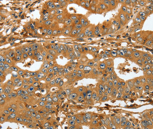 RAP1A Polyclonal Antibody (E-AB-13927)