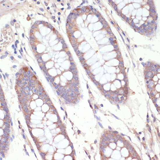 HMGCR Polyclonal Antibody (E-AB-66969)