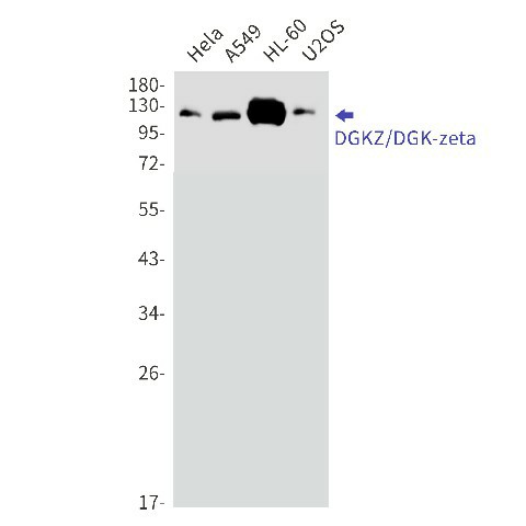 Recombinant DGKZ Monoclonal Antibody (E-AB-81501)