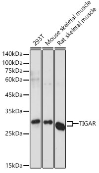 TIGAR Polyclonal Antibody (E-AB-92238)