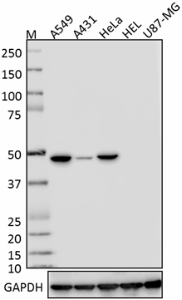 Purified anti-Cytokeratin 18 Antibody (628401)