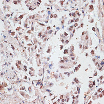 DKC1 Polyclonal Antibody (E-AB-64375)