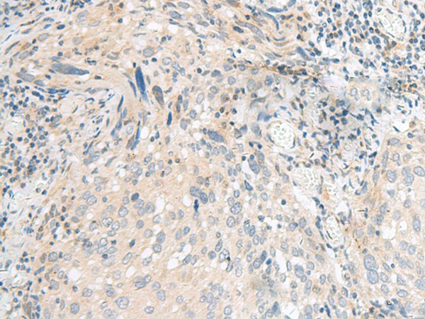 CALCOCO1 Polyclonal Antibody (E-AB-52770)