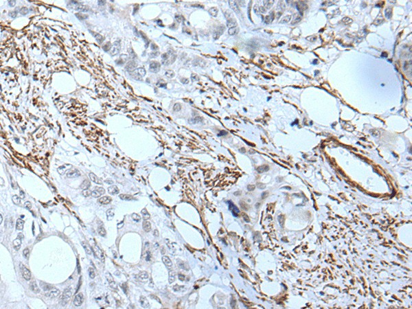 GJA5 Polyclonal Antibody (E-AB-18223)
