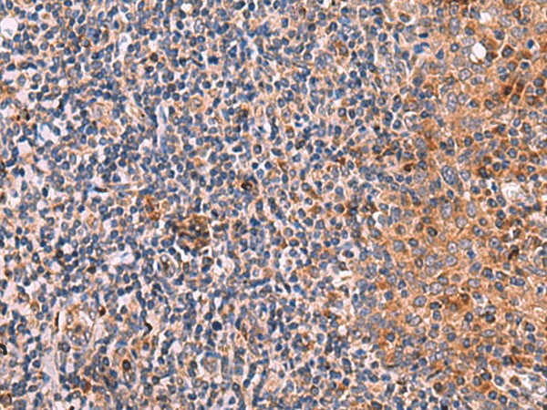 KLK9 Polyclonal Antibody (E-AB-18152)