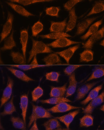ME3 Polyclonal Antibody (E-AB-66576)