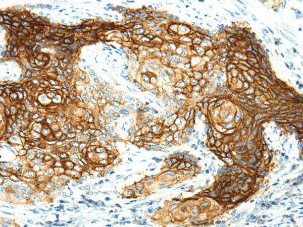 AQP3 Polyclonal Antibody (E-AB-17294)