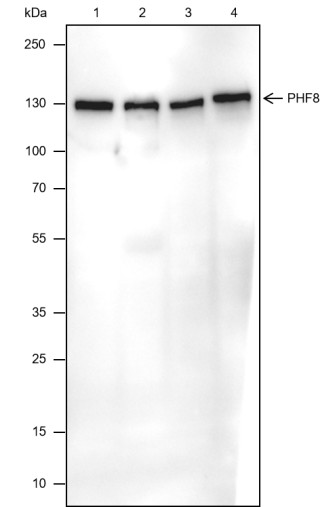 Recombinant PHF8 Monoclonal Antibody (AN301802L)