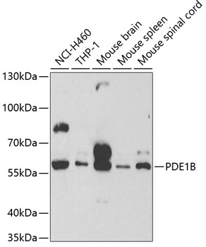 PDE1B Polyclonal Antibody (E-AB-60606)