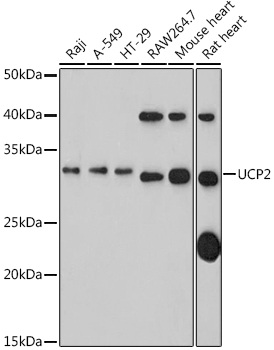 UCP2 Polyclonal Antibody (E-AB-92580)