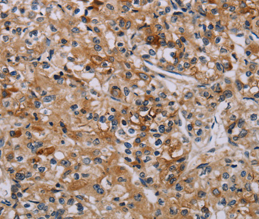 AATK Polyclonal Antibody (E-AB-13451)