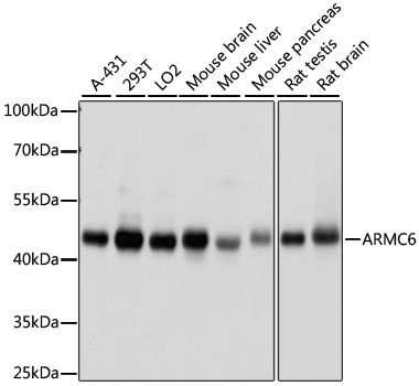 ARMC6 Polyclonal Antibody (E-AB-66629)