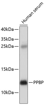 PPBP Polyclonal Antibody (E-AB-67387)