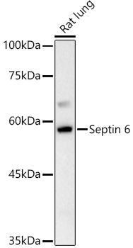 Septin 6 Polyclonal Antibody (E-AB-92843)